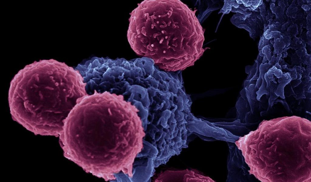Клетки иммунной системы распространяют раковые опухоли